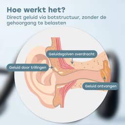 Audyn Bone Rondo - Sport Oordopjes - Bone Conduction Headphone - Bluetooth - Open Ear Oortjes - Draadloos - 9 Uur Batterij — thumbnail 4