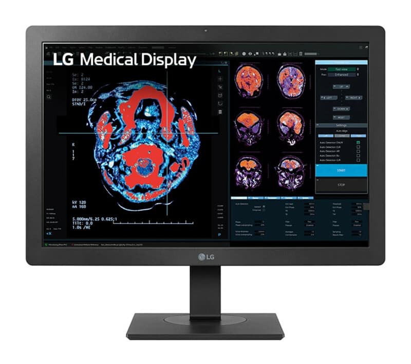 LG 24HR513C-B computermonitor 61 cm Full HD 1920 x 1080 pixels zwart — afbeelding 1