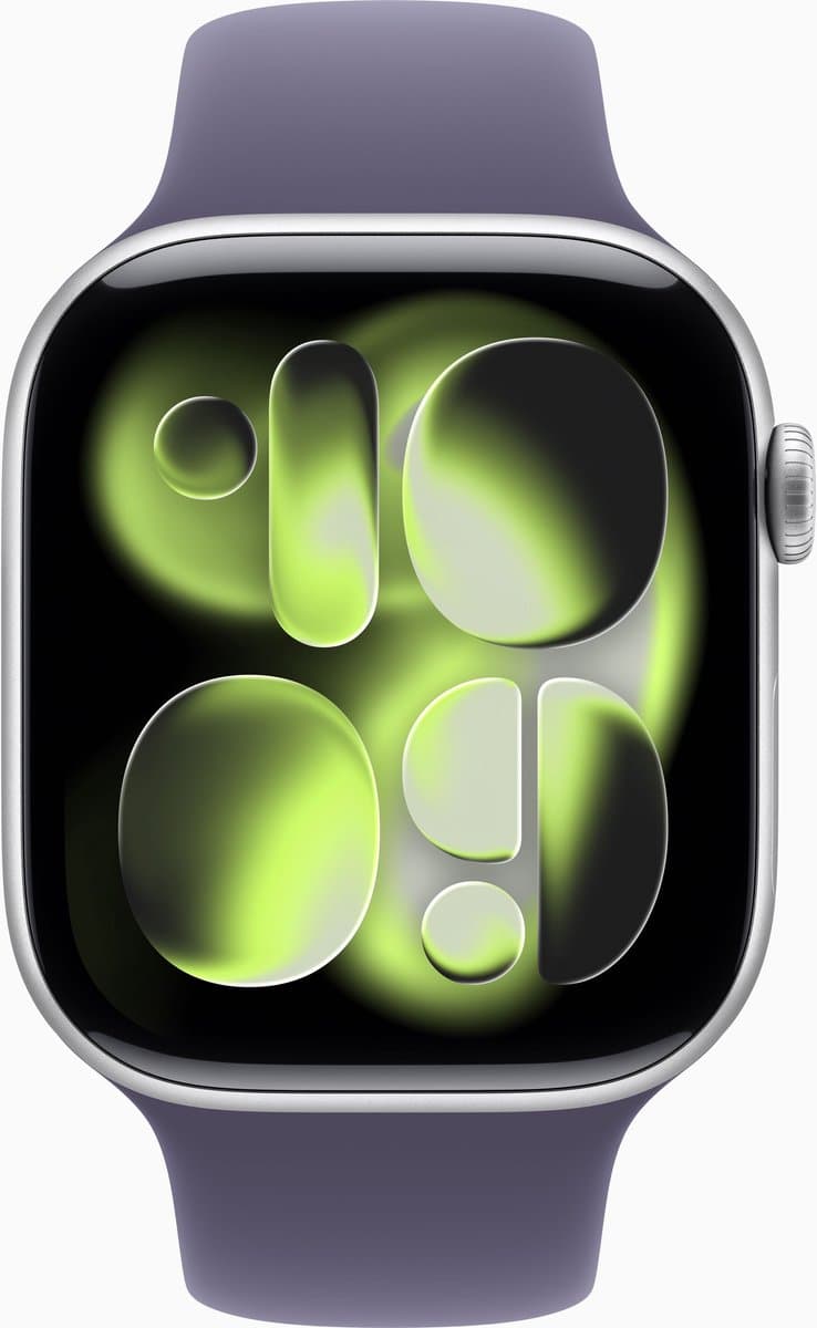 Apple Watch Series 11 — afbeelding 1